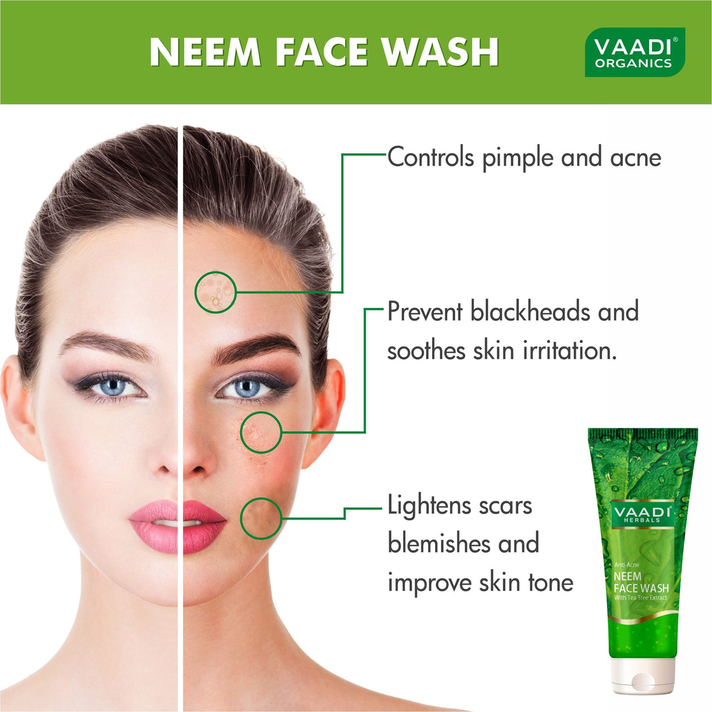 Anti Acne Organic Neem Face Wash with Tea Tree Extract - Controls Acne Heals Skin ( 4 x 60 ml/2.1 fl oz)