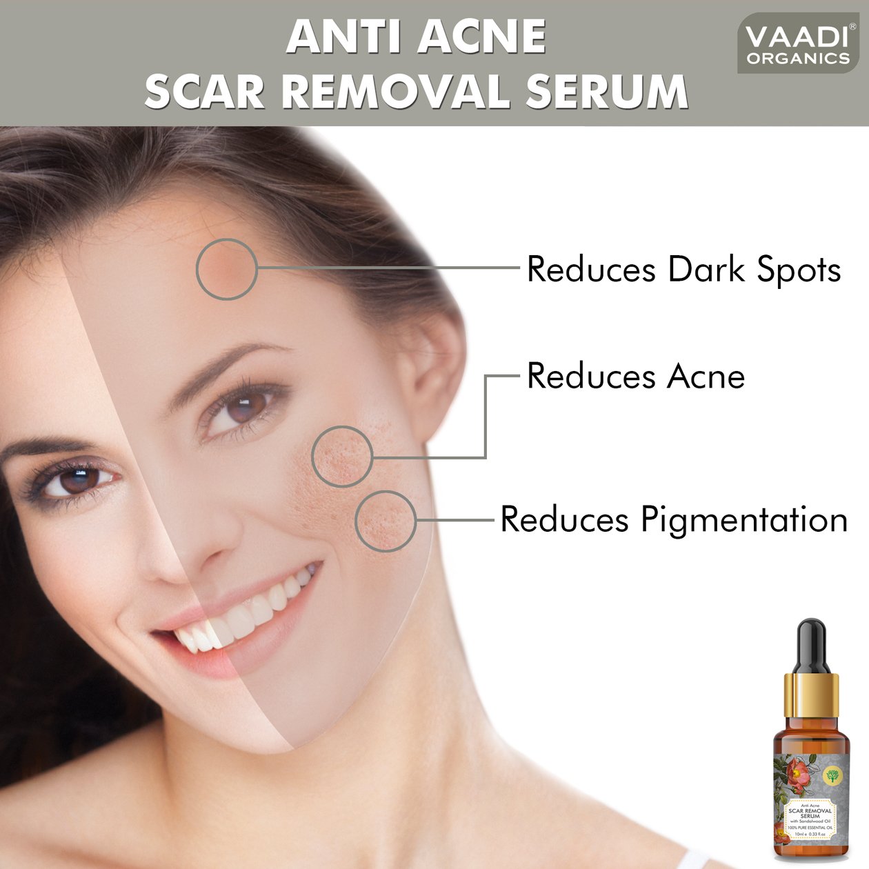Scar Removal Serum (Pure Mix of Sandalwood Oil, Steam Distilled Neem & Fenugreek Extract) - Reduces Acne, Dark Spots & Pigmentation (10 ml/ 0.33 oz)
