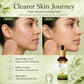 Organic Anti-Acne Serum With Glycolic & 2% Salicylic Acid (30 gms / 1.02 fl.oz)
